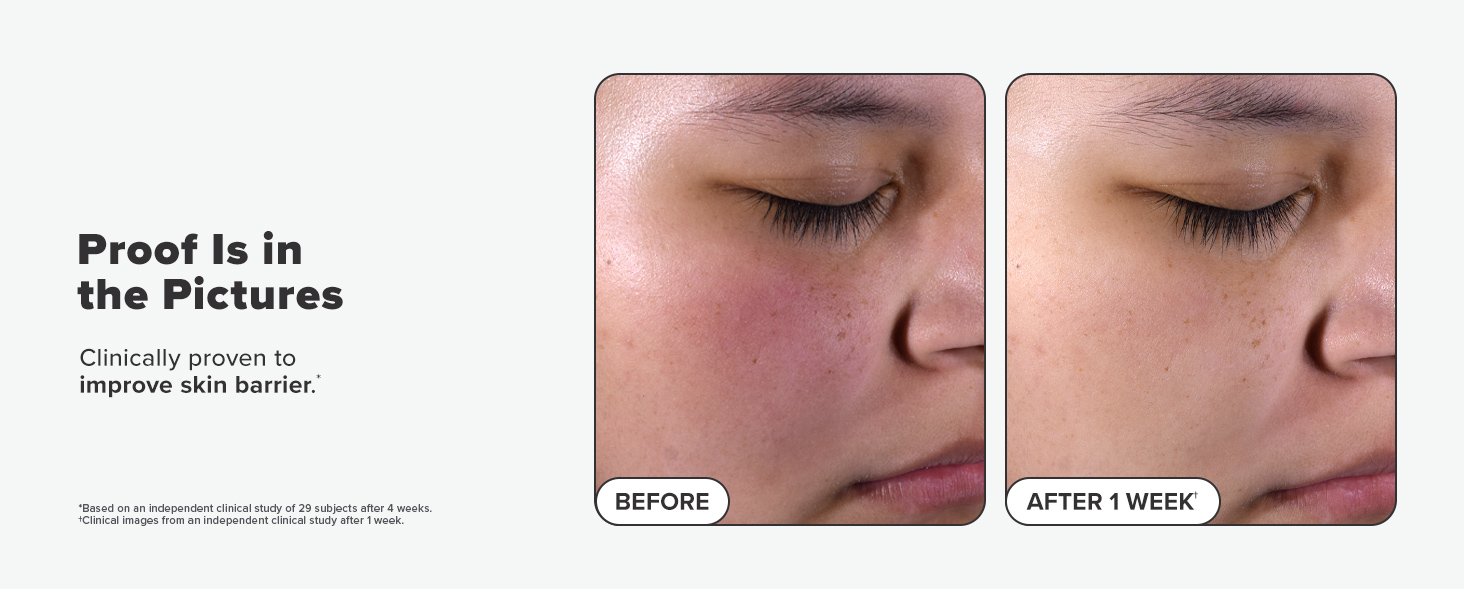 before after 4