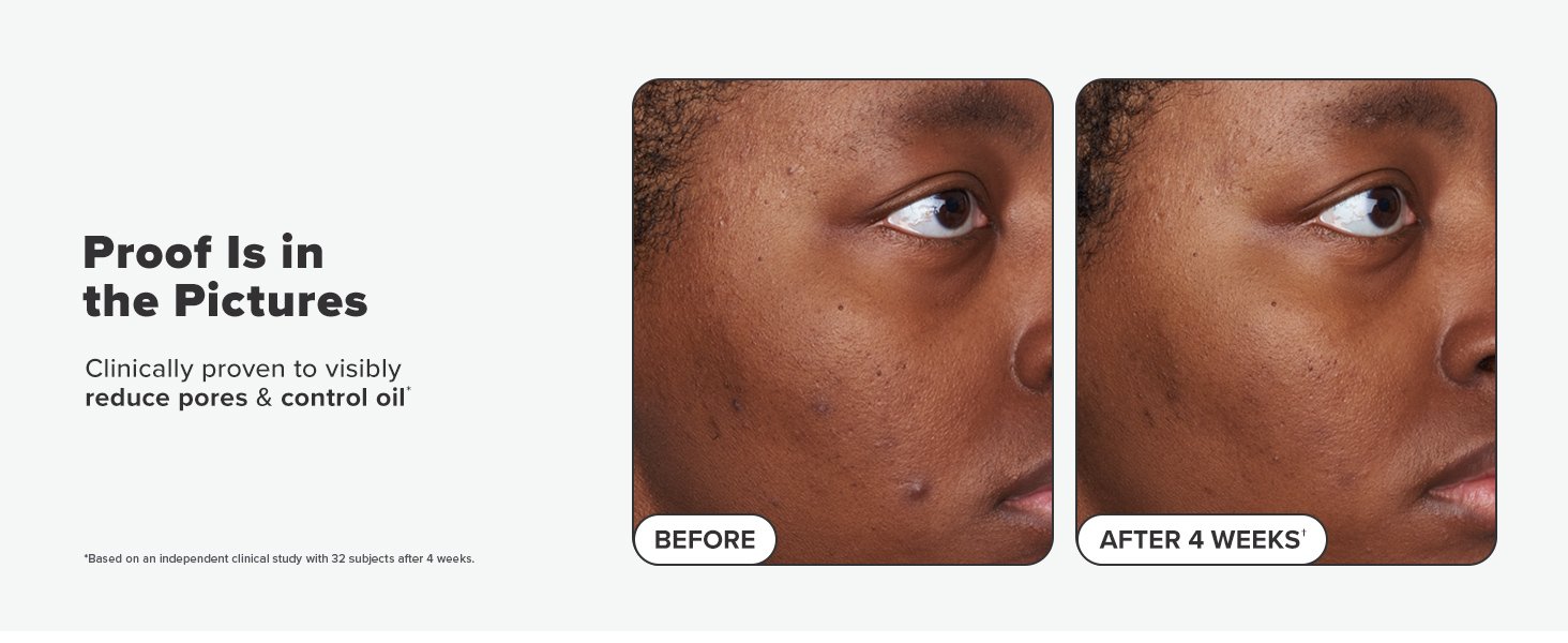 before after 2