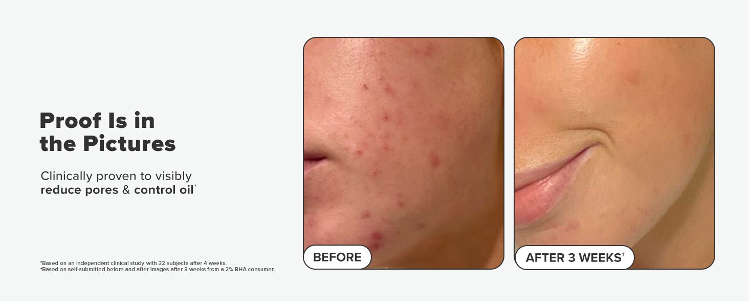 before after 1