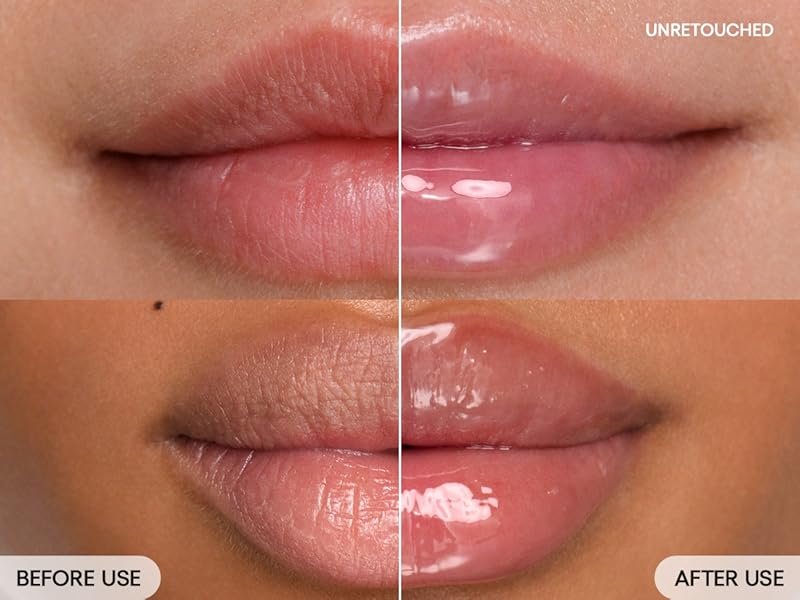 B&A